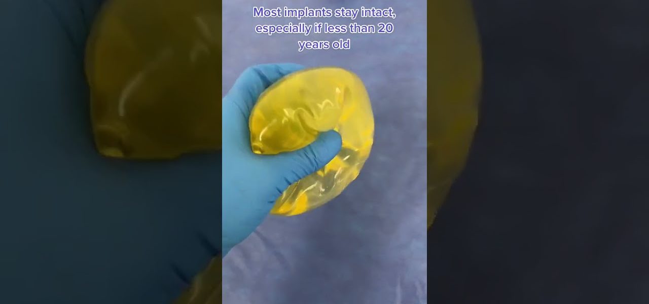 Why Are These 18 Year Old Breast Implants Slightly Yellow? #shorts #breastimplants