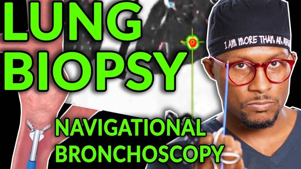 Lung Biopsy: A day in the life of a Pulmonary Intervention